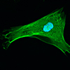 ZsGreen1 labeled cell