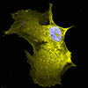 ZsYellow1 labeled cell
