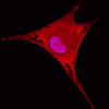 tdTomato labeled cell