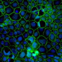 Learn more about how Cellartis Intestinal Epithelial Cells (from ChiPSC18) and how they can improve your research 
