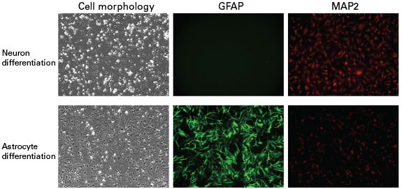 Immunolabeling of neuron marker, MAP2, and astrocyte marker, GFAP
