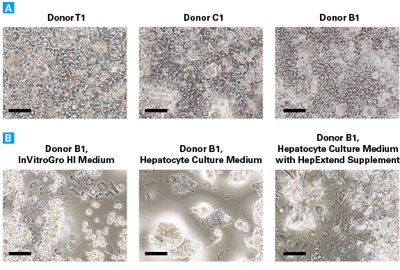 Morphology of primary hepatocytes cultured in Cellartis Power Primary HEP Medium and three commercially available hepatocyte maintenance media at Day 28 post-thawing
