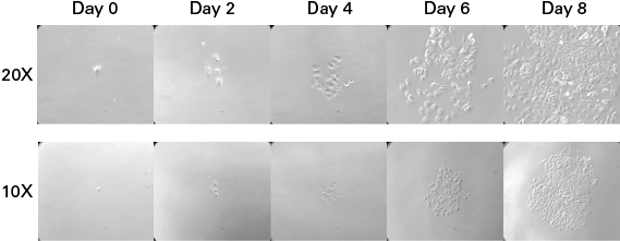 supports emerging hiPS cell colonies