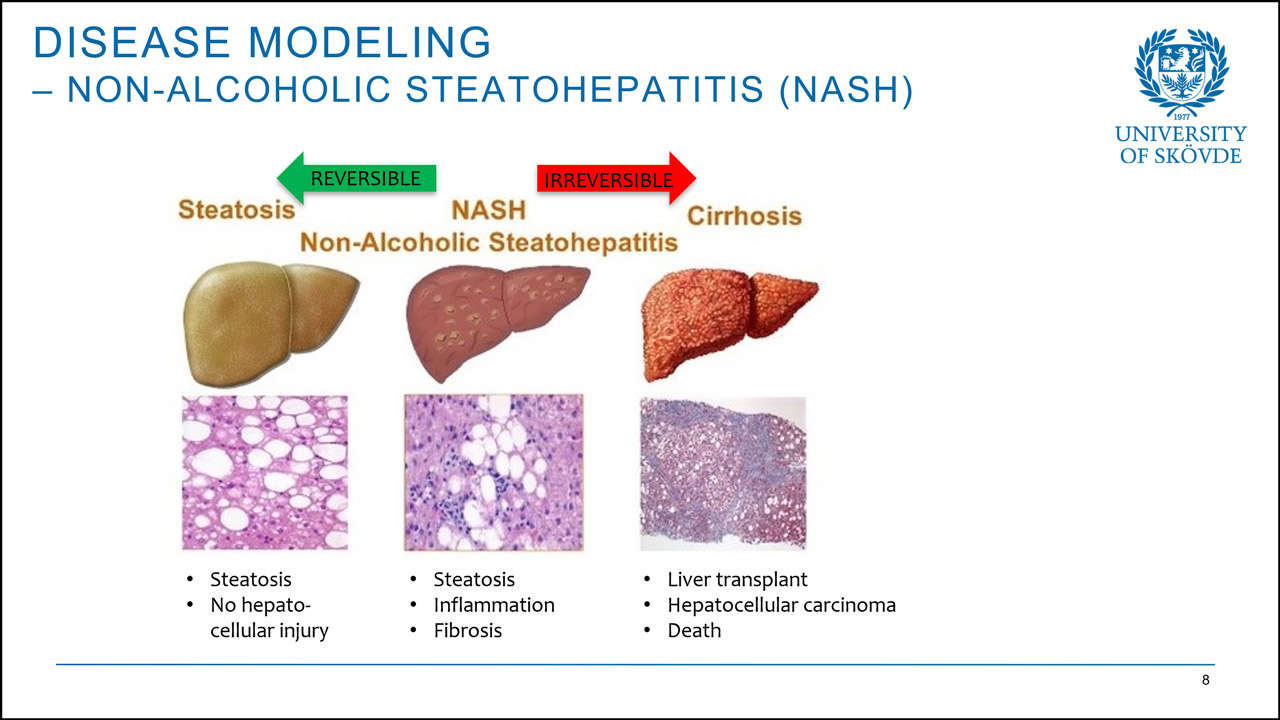 Combining hiPSC-derived hepatocytes and bioinformatics—investigating the potential to model non-alcoholic steatohepatitis (NASH)