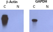 Example of DSN normalization of cDNA libraries.