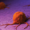 Learn how CAR T cells are improving cancer treatment