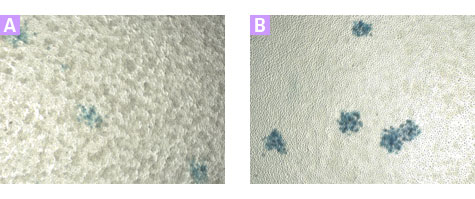 Identification of infection foci in a lawn of Sf21 cells, using the BacPAK Baculovirus Rapid Titer Kit