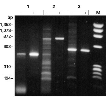 Increased yield and specificity of RT-PCR with TaqStart Antibody