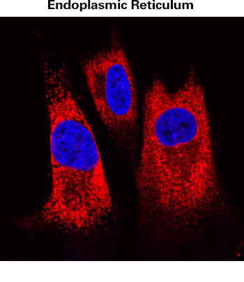 Fluorescent labelling of endoplasmic reticulum (ER)
