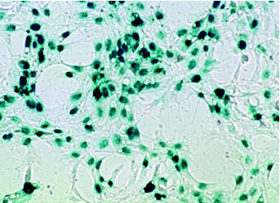 Transfection of HeLa cells with NucleoBond-purified plasmid DNA